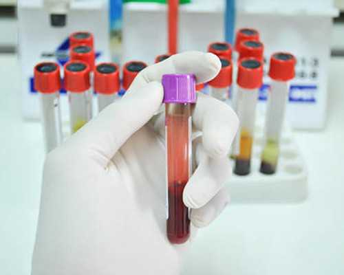 卵巢早衰，根源不在雌激素低❗ 福州哪有供卵试管