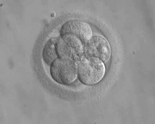 我才25岁，内异症？巧囊？ 厦门试管供卵网