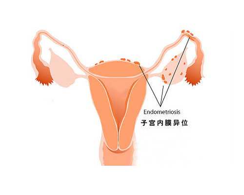 代生套餐，养囊失败的三大原因？胚胎质量不佳多是主因